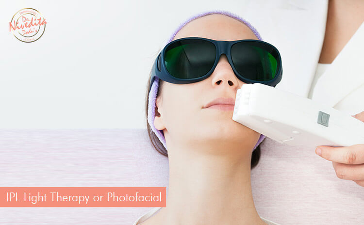 ipl-light-therapy-or-photofacial