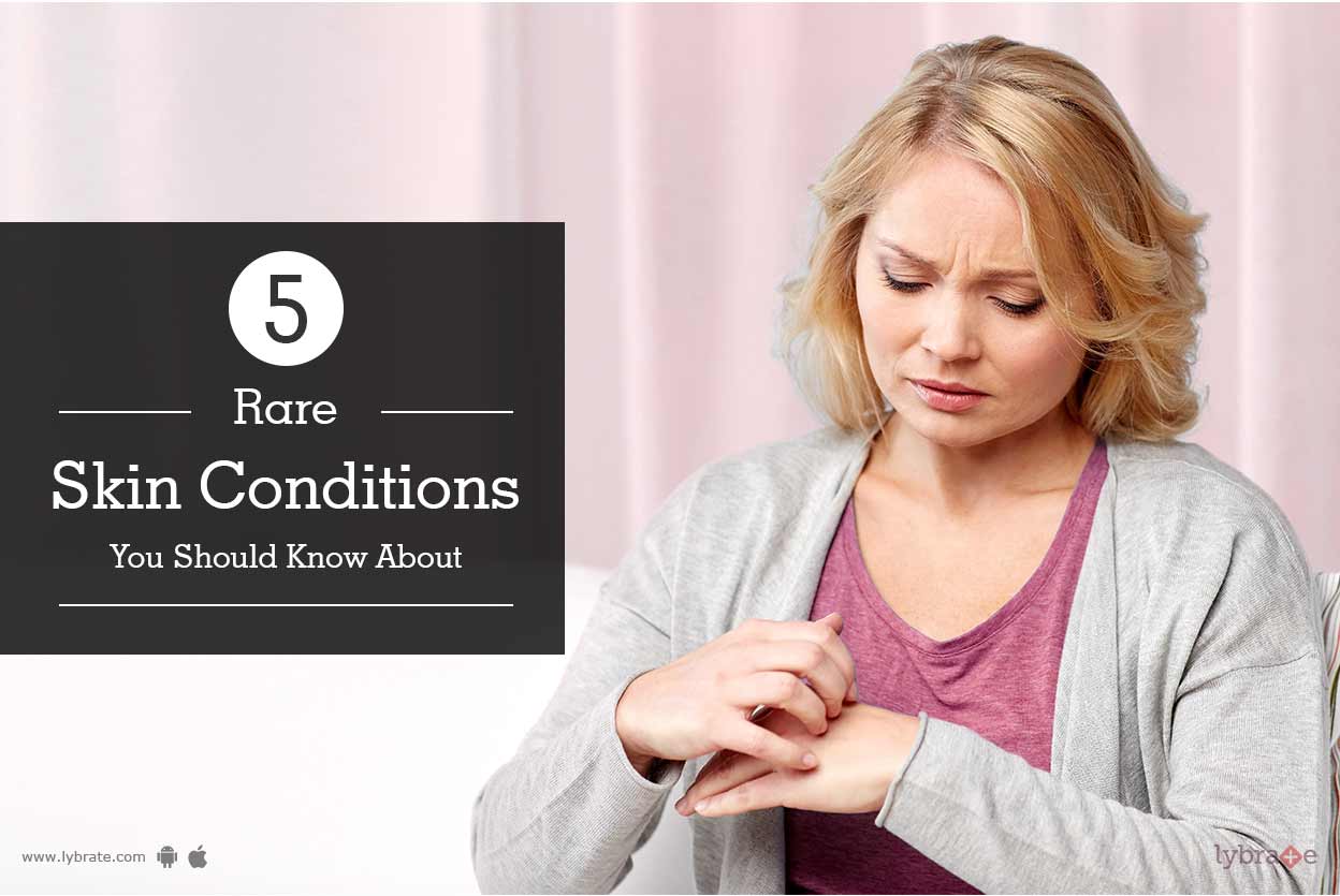 Rare Skin Conditions You Should Know About