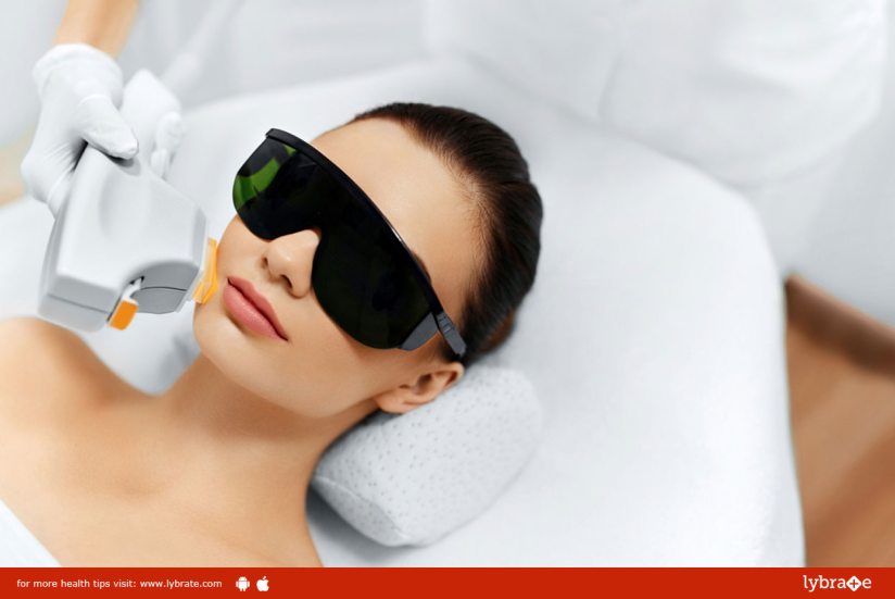 All About Laser Photofacial