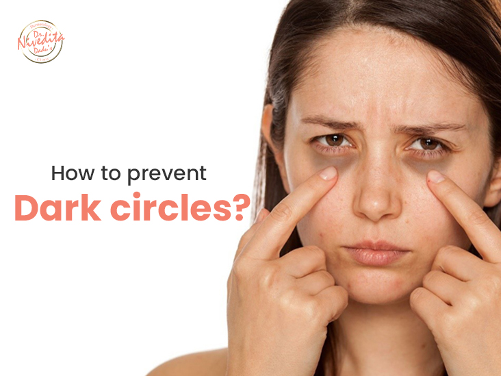 Dark Circles Causes And Their Treatment
