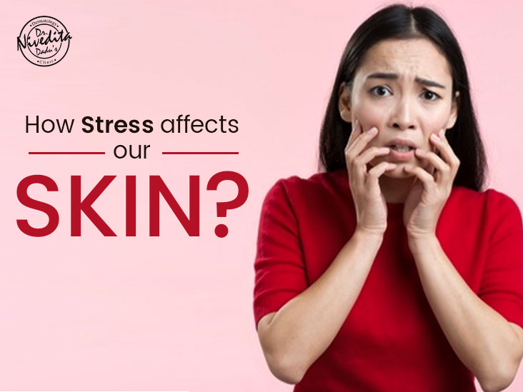 How Stress Affects Our Skin