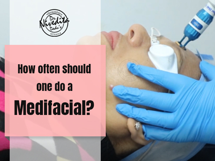 medifacial treatment